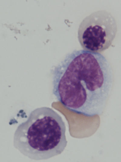 Image of human CD45+ blood cells differentiated from iPS cells.